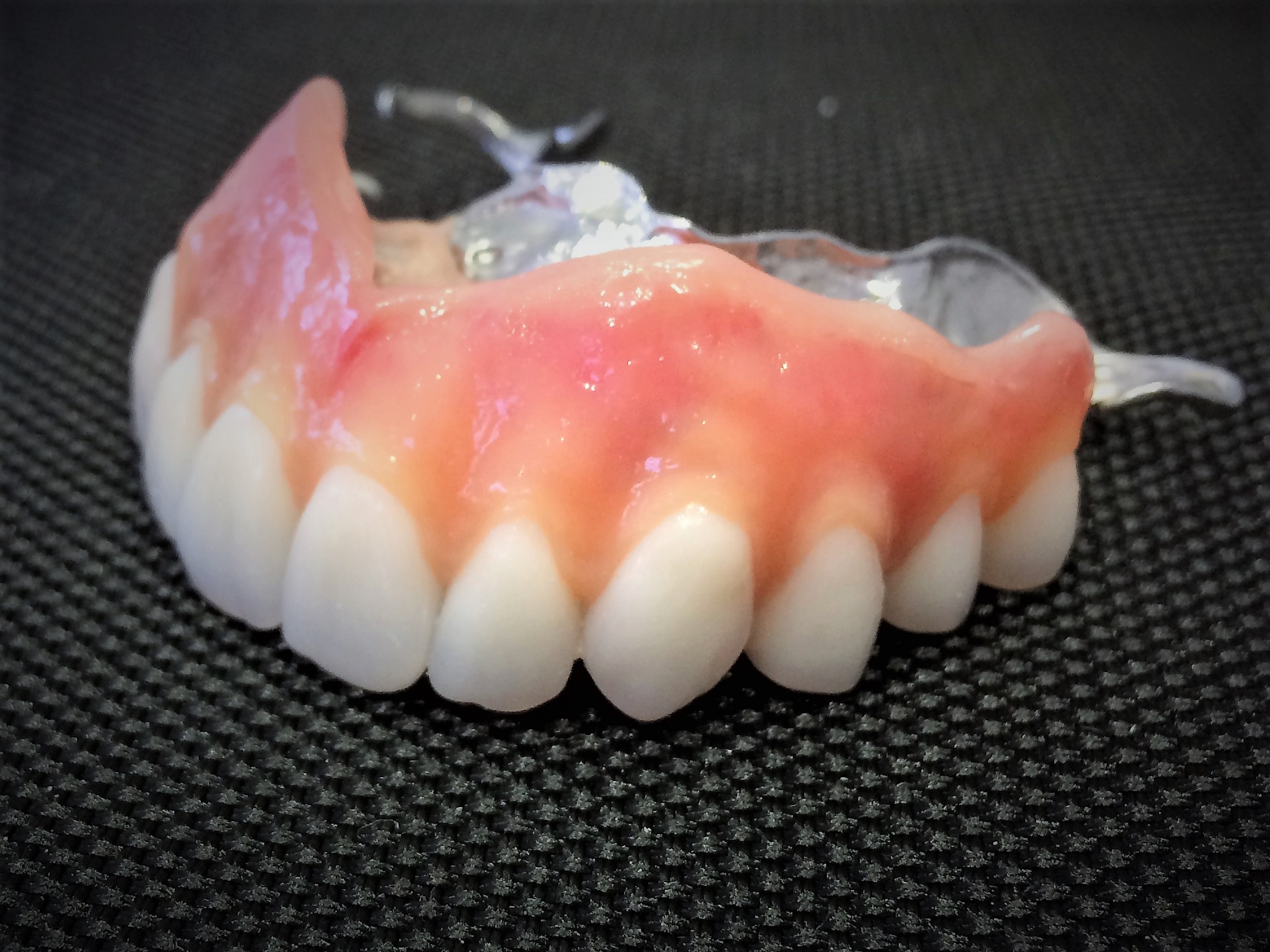 Customised Dentures Stones Bank Dental Laboratory